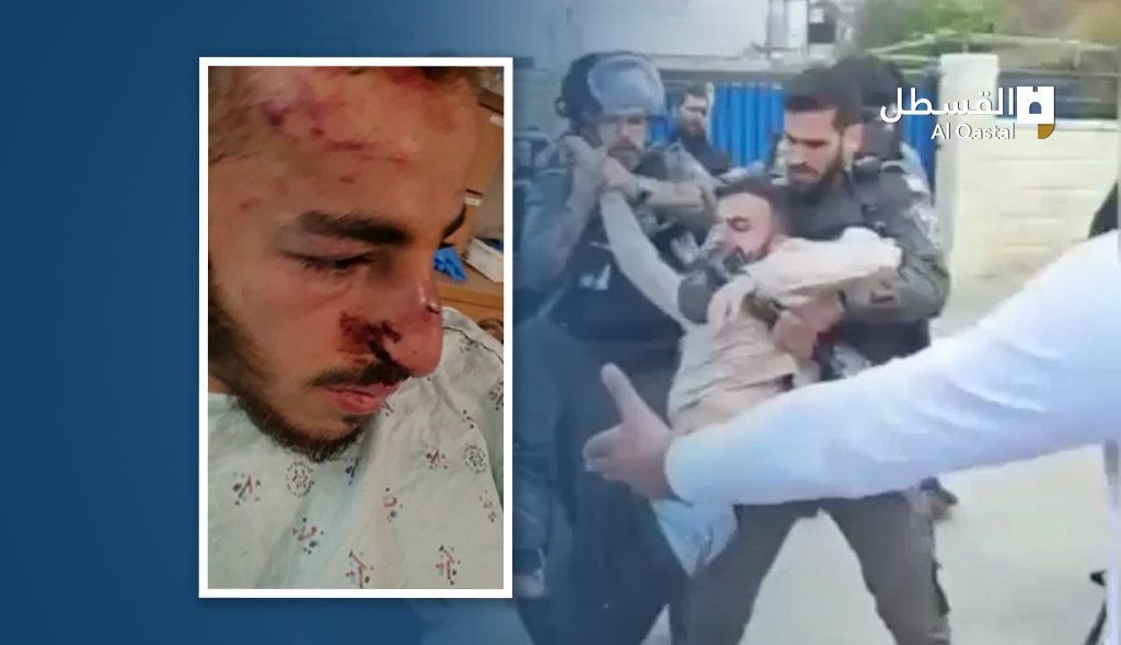 "ضربوه حتى فقد الوعي".. الاحتلال يعتدي على محمد عويسات من جبل المكبر